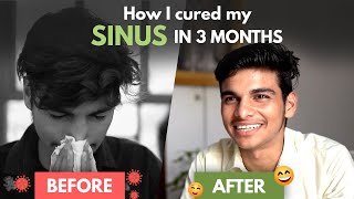 7Year Old Sinus Problem Gone in 3 Months  Sinus Treatment at Home [upl. by Fu131]