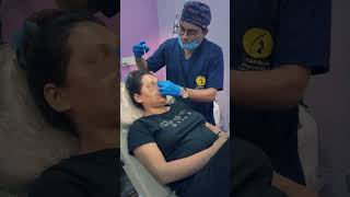 Lip Filler amp Nose Correction Treatment  Kolkata  youtubereels youtubereelsviral youtubeshorts [upl. by Silirama886]