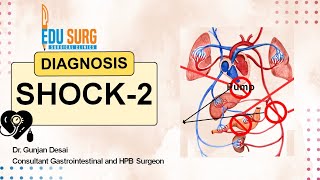 Want to Master Shock diagnosis Watch This Now  types of shock  Part 2 [upl. by Gareth665]