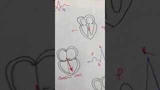 Basic ECG Part 1 bangla [upl. by Annai]