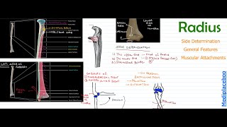 Radius  Side Determination  General Features  Muscular Attachments  Mindmaps  Mediplaceboo [upl. by Eeclehc]