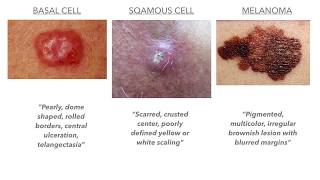 Dermatology on USMLECOMLEX [upl. by Adnalu]