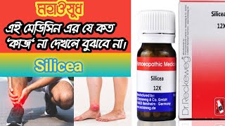 Silicea Homeopathic Medicine Uses amp Symptoms।Silicea 200। Silicea 12X। সাইলিসিয়া হোমিওপ্যাথি ডোজ। [upl. by Kay467]