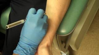 Allergy Testing Step 1 Skin Prick Testing [upl. by Woodman895]