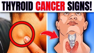 10 WARNING Signs Of Thyroid Cancer You Must Not IGNORE [upl. by Conn]