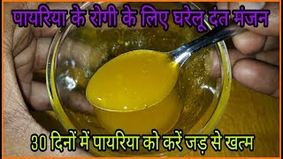 30 दिनों में करिए पायरिया रोग को जड़ से खत्म  Pyorrhea Treatment At Home  Pyorrhea Home Remedies [upl. by Nyrac]