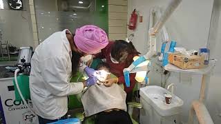 🦷🌟 Tooth Extraction of a Child under Nitrous Oxide Inhalation Sedation  laughing gas 🤣 [upl. by Adnala729]