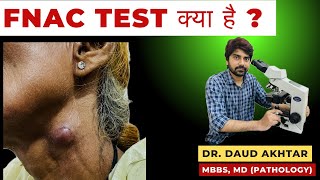 FNAC TEST HINDI कैसे इस टेस्ट से टीबी से लेकर कैंसर तक का पता चलता है [upl. by Etnuahc]