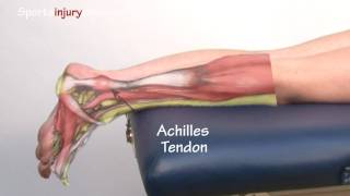 Achilles Tendonitis  Tendinopathy  Explained in 90 Seconds [upl. by Barb510]