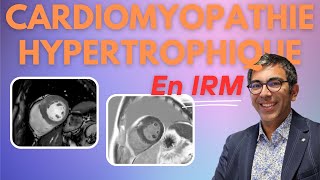 Cardiomyopathie Hypertrophique CMH en IRM  lessentiel en 11 minutes [upl. by Hsemar281]