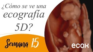 Ecografia de 15 semanas de embarazo Increíble 😮 [upl. by Artiek]