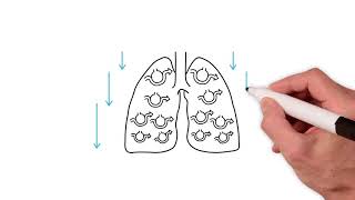 Everything you need to know about the ventilation perfusion ratio [upl. by Sosthina]