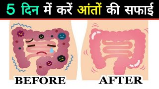 आंतो की सफाई करे  Body Detoxification  Pet ki safai kasie kare  Lupizyme syrup  dr tarun [upl. by Aicyle]