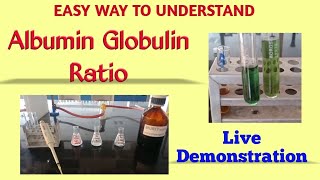 Albumin globulin ratio  Total protein estimation  Biuret method  Albumin estimation  BCG method [upl. by Fanestil]