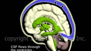 Hydrocephalus and Cerebrospinal Fluid CSF circulation by Dr Cal Shipley MD [upl. by Thordis13]