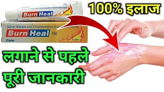 Burn Heal Cream Use in HindiAag se jale ka Dava How to use Burn heal creamBurn Heal kaise Lagayen [upl. by Lajib]