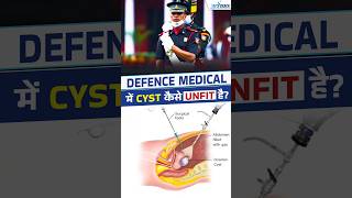 Can Cysts Cause Rejection in SSB Medical [upl. by Limak607]