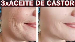 ¡Aceite de Castor  Bicarbonato de sodio Haz esto y las arrugas desaparecen Botox Natural [upl. by Husein]