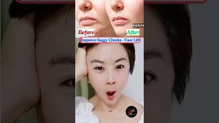 Improve Saggy Cheeks  Face Lift facelift yogafacial yoga facialyoga sagging shorts [upl. by Eugeniusz952]