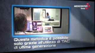 COLONSCOPIA VIRTUALE a Roma  Medicenter Group [upl. by Hillary]