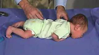 physical exam Newborn Normal Positions  Prone [upl. by Ledba]