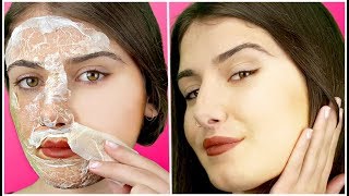 How To Remove Facial Hair At Home INSTANTLY  My Simple Remedies [upl. by Adiuqram]