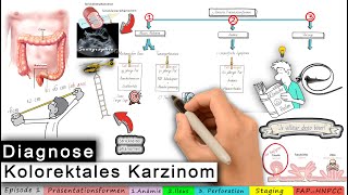 kolorektales Karzinom Ep 13 Diagnose [upl. by Stefanie]