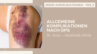 Bluterguss und Entzündung nach Operation  Komplikationen – Teil 2  Dr Arco – Aesthetik Klinik [upl. by Eelahc]