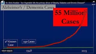 Dr Chris Knobbe onderzoekt de rol van plantaardige oliën als aanjager van chronische ziekten [upl. by Asillem572]