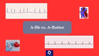 Atrial fibrillation vs Atrial Flutter [upl. by Eiser]