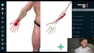 Palmaris Longus  Trigger Point of the Week [upl. by Eilyac]