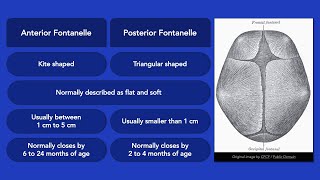 Fontanelles [upl. by Navy]