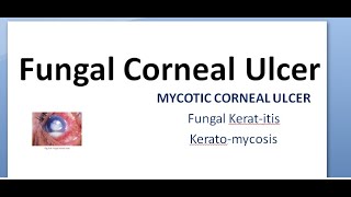 Ophthalmology 115 a Fungal Corneal Ulcer Mycotic Keratitis KeratoMycosis Eye treatment fungus anti [upl. by Marrilee]