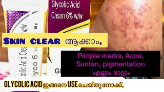 How to use glycolic Acid creamGlyco 6ww Review in malayalam [upl. by Enyawd420]