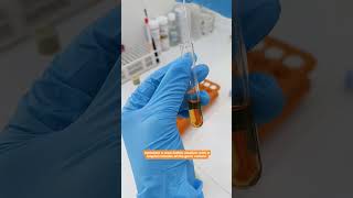 Indole test microbiology youtuber labradorretriever mbbs pathology [upl. by Landers]