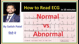 How to read an ECG normal vs abnormal ECGpna1 satishpatel [upl. by Lanta]