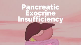 Pancreatic Exocrine Insufficiency  Gastrointestinal Society [upl. by Alatea]