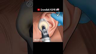 ASMR  Ear wax Removal amp Ear Cleaning Animation shorts satisfying asmr animation earcleaning [upl. by Scherle]