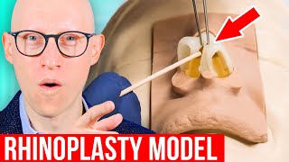 RHINOPLASTY Explained by Plastic Surgeon [upl. by Broddie778]