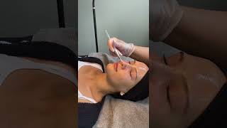 Fruchtsäurepeeling Mit Liebe zum Detail Kosmetiksalon Berlin 🍍 shortsvideo skincare fruchtsäure [upl. by Hamel]