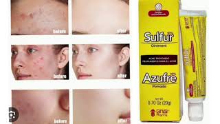 Sulfur Acne Treatment Cream Ointment [upl. by Andri]