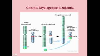 Chronic Myelogenous Leukemia  CRASH Medical Review Series [upl. by Htebzile593]