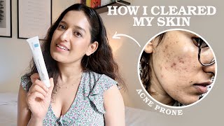 My 3 Step EvidenceBased Skincare Routine As A Doctor  HOW I CLEARED MY ACNE  Affordable Easy [upl. by Colwin]