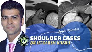 Shoulder Cases by Dr Utkarsh Kabra  MRI Quiz  Shoulder Instability  ALPSA  GAGL  AC Dislocation [upl. by Cavanaugh]