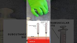 Hypodermic Needle and Syringe Choice Basics [upl. by Suellen212]