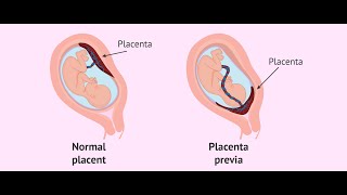 Placenta development part 1general embryologyشرح بالعربي [upl. by Etteyniv461]