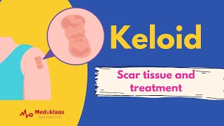 Keloid scar tissue and treatment [upl. by Yerkovich204]