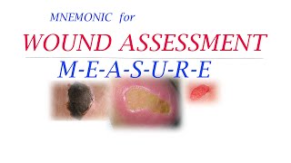 MNEMONIC FOR WOUND ASEESSMENT [upl. by Adiari]