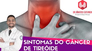 Sintomas do câncer de tireoide  Caroço no pescoço Rouquidão Dor na garganta [upl. by Zelde802]