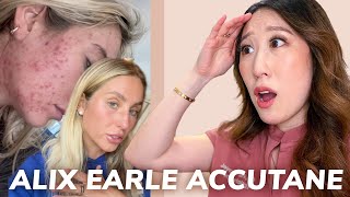 Dermatologist Reacts to Accutane Journey from Alix Earle  Side Effects Hair Loss Acne Recurrence [upl. by Frierson]